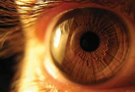 Image result for actomatopsia