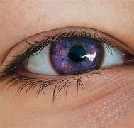 Image result for Reare Eye
