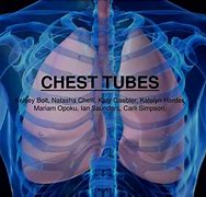 Image result for Pneumothorax Chest Tube Placement