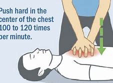 Image result for Bystander CPR
