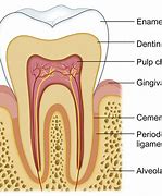 Image result for Embedded Teeth