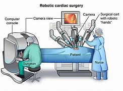 Image result for Robotic Bypass Surgery