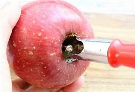 Image result for Apple Core Malrotation
