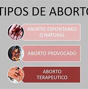 Image result for aborro