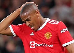 Image result for Anthony Martial Injury