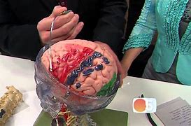 Image result for Back of Brain Surgery