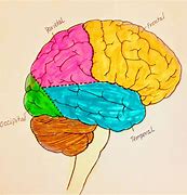 Image result for Brain Surgery Cartoon