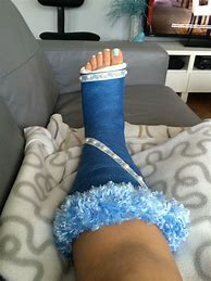 Image result for Her Broken Foot Cast