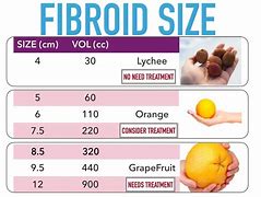 Image result for Fibroid Size Chart in mm
