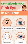Image result for Pink Eye in Children