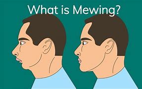 Image result for Baby Mewing Meme
