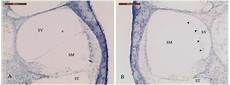 dermatite nell orecchio interno effetto dell idrope endolinfatico nella diffusione della dermatite nell orecchio interno effetto dell idrope endolinfatico nella diffusione della