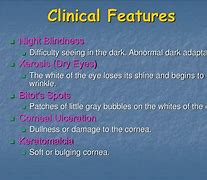 Image result for Congenital Stationary Night Blindness