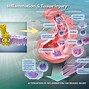Image result for Inflammation Process