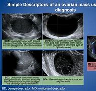 Image result for Ovarian Functional Cyst vs Septated Cyst On Ultrasound