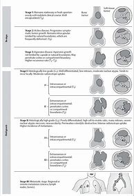 Image result for 6 Cm Tumor