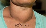 Image result for bocio