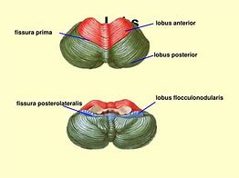 Image result for Plexus Choroideus