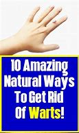 Image result for Warts On Face Removal Natural