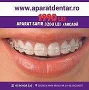 Image result for Fiksni Ortodontski Aparat