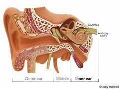 Image result for Over-Ear Hearing Aids