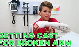 Image result for My Broken Arm Cast