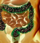 Image result for Large Intestine Bacteria