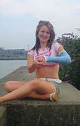 Image result for Arm Cast by the Bay