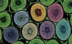 Image result for Diseases Under Microscope