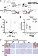 Image result for P53 AML