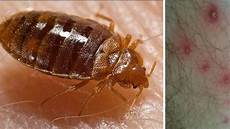 cimici materasso cimici dei letti ecco dove controllare il materasso e cimici materasso cimici dei letti ecco dove controllare il materasso e
