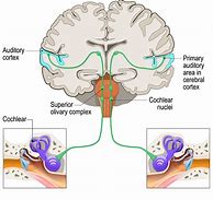 Image result for Auditory Brain