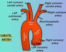 Image result for Common Carotid Artery