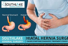 Image result for hienal