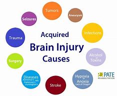 Image result for Acquired Brain Injury