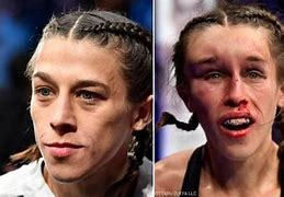 Image result for UFC Fighters After Fight