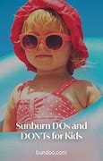 Image result for SunBurn for Kids