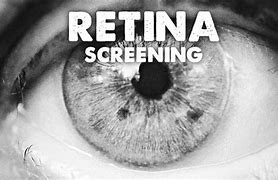 Image result for Retina Screen