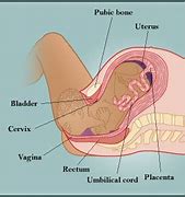 Image result for Diagram of Baby Delivery