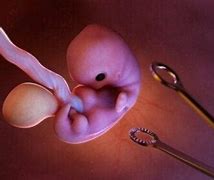 Image result for aboryo