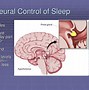 Image result for REM Sleep Disorder