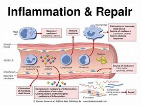 Image result for Inflammation Template
