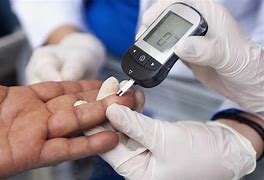 Image result for What Is a Random Blood Sugar Test From Vein
