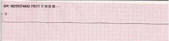 Image result for asystole