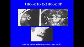 Image result for 2 Inch J-Hook Mulipuus Clip