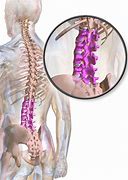 Image result for Lumbar Spine Disc
