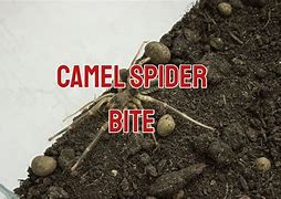 Image result for Camel Spider Wounds