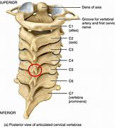 Image result for Cervical Spine Bones