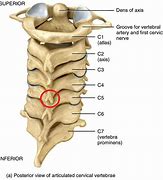 Image result for C5 C6 C7 Vertebrae