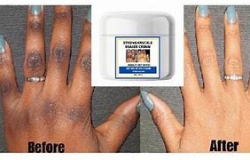 Image result for Hand Cream for Dark Knuckles